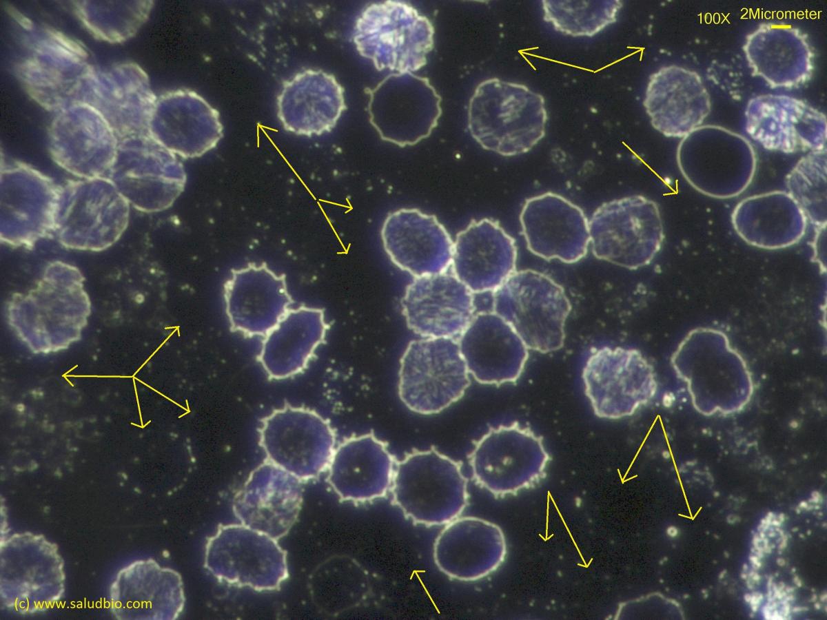 Formación de eritrocitos fantasma en campo oscuro