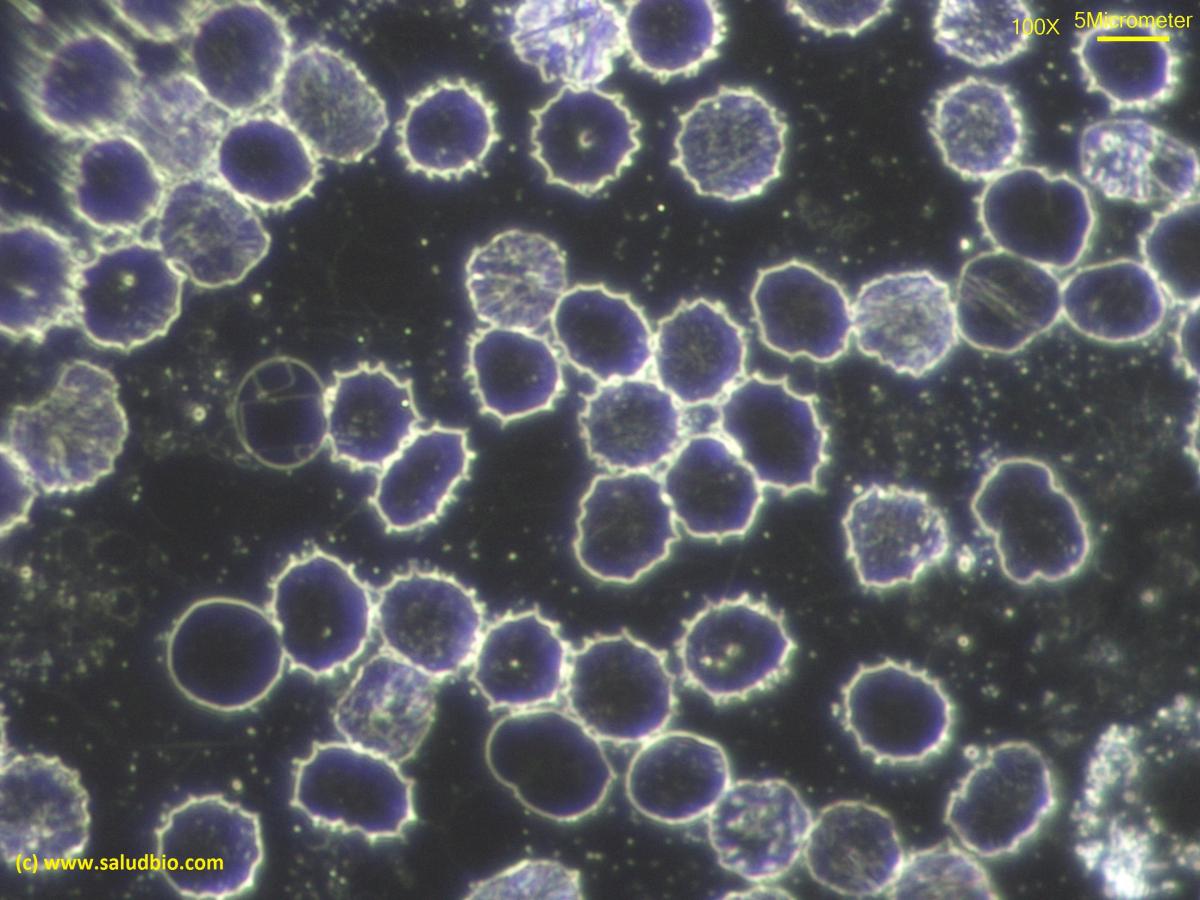 Formación de eritrocitos fantasma con microscopio de campo oscuro