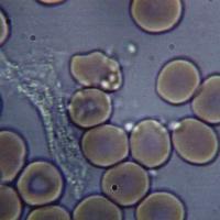 Leucocito de la sangre, célula del sistema inmunológico