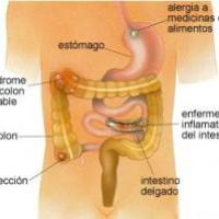 Síntomas y causas de diarrea