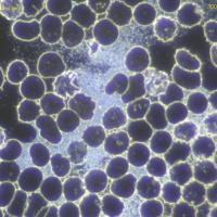 Eritrocitos y protitos azules con microscopio de campo oscuro 90 horas. Velo protitos