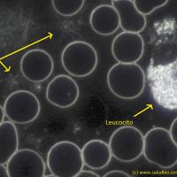 Glóbulos rojos, leucocito y fibrina con microscopio de campo oscuro