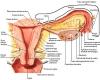 Tratamientos para la endometriosis