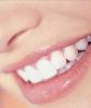 Remedios para tener los dientes blancos